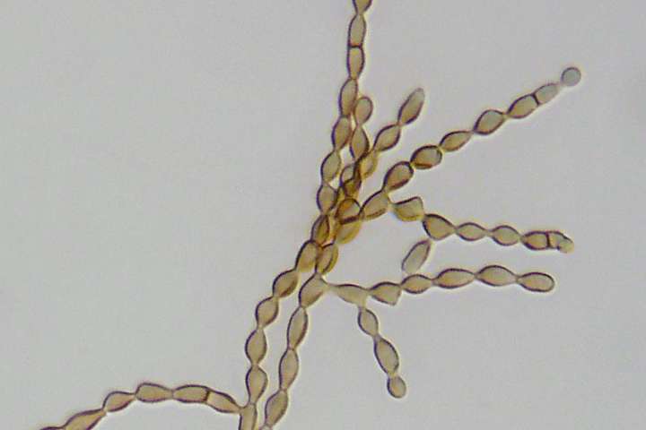 Cladosporium spores under a microscope