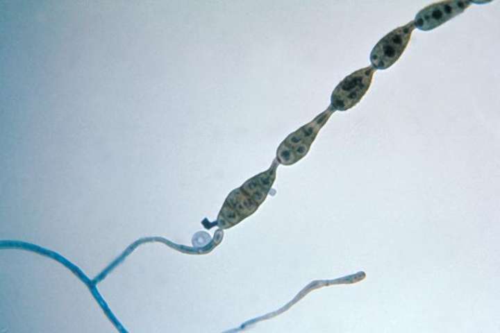 A chain of Alternaria spores under a microscope